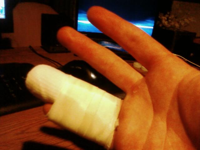 nobo's hand injury: mmm mmmm good