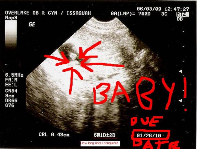 Baby Watch 2