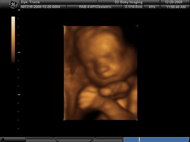 New Pics of Keisjaa & Alexinaa's "Beanie"