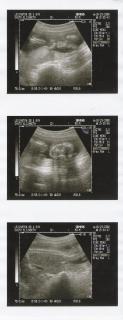 my ultrasound pics 10-29-08 my ultrasound pics 10-29-08