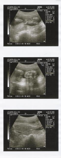 my ultrasound pics 10-29-08