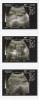 my ultrasound pics 10-29-08