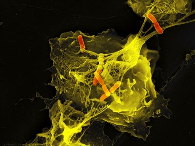 Neutrophil (NETS)