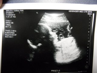 Babymo
