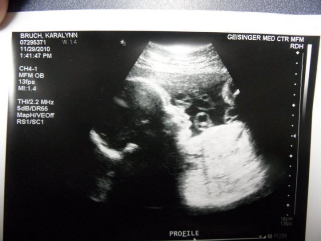 Babymo