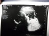 Babymo